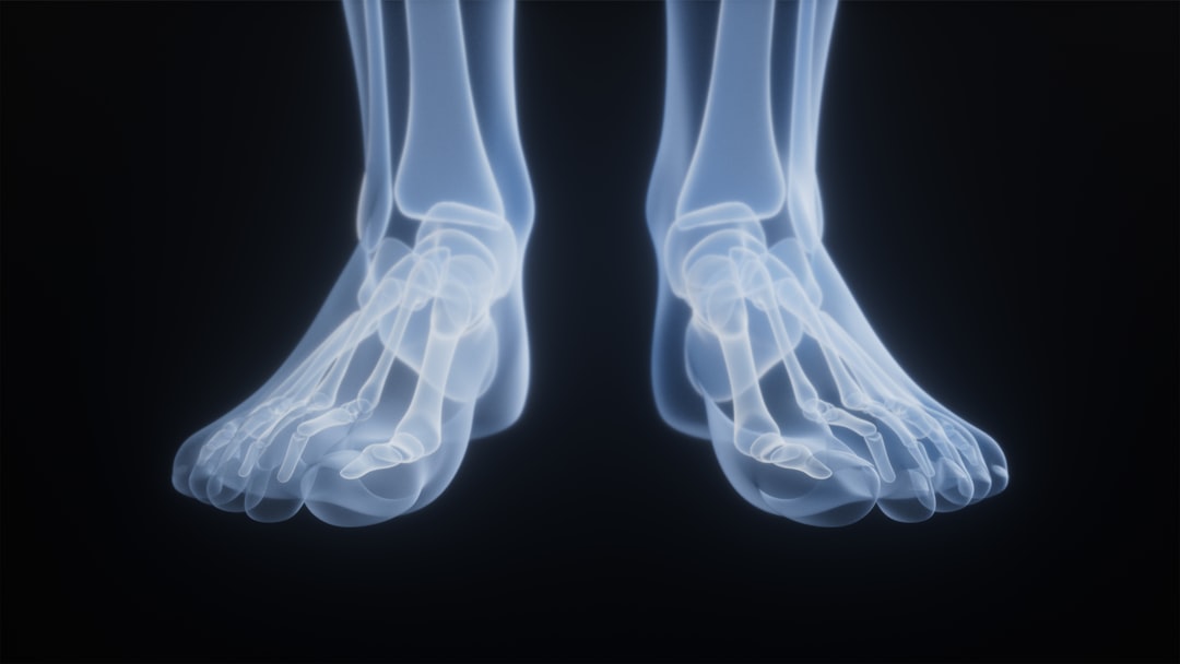 X-ray of human feet against a black background.